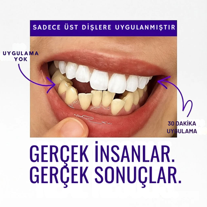 Duyora - Çift Etkili Diş Beyazlatma Bantları
