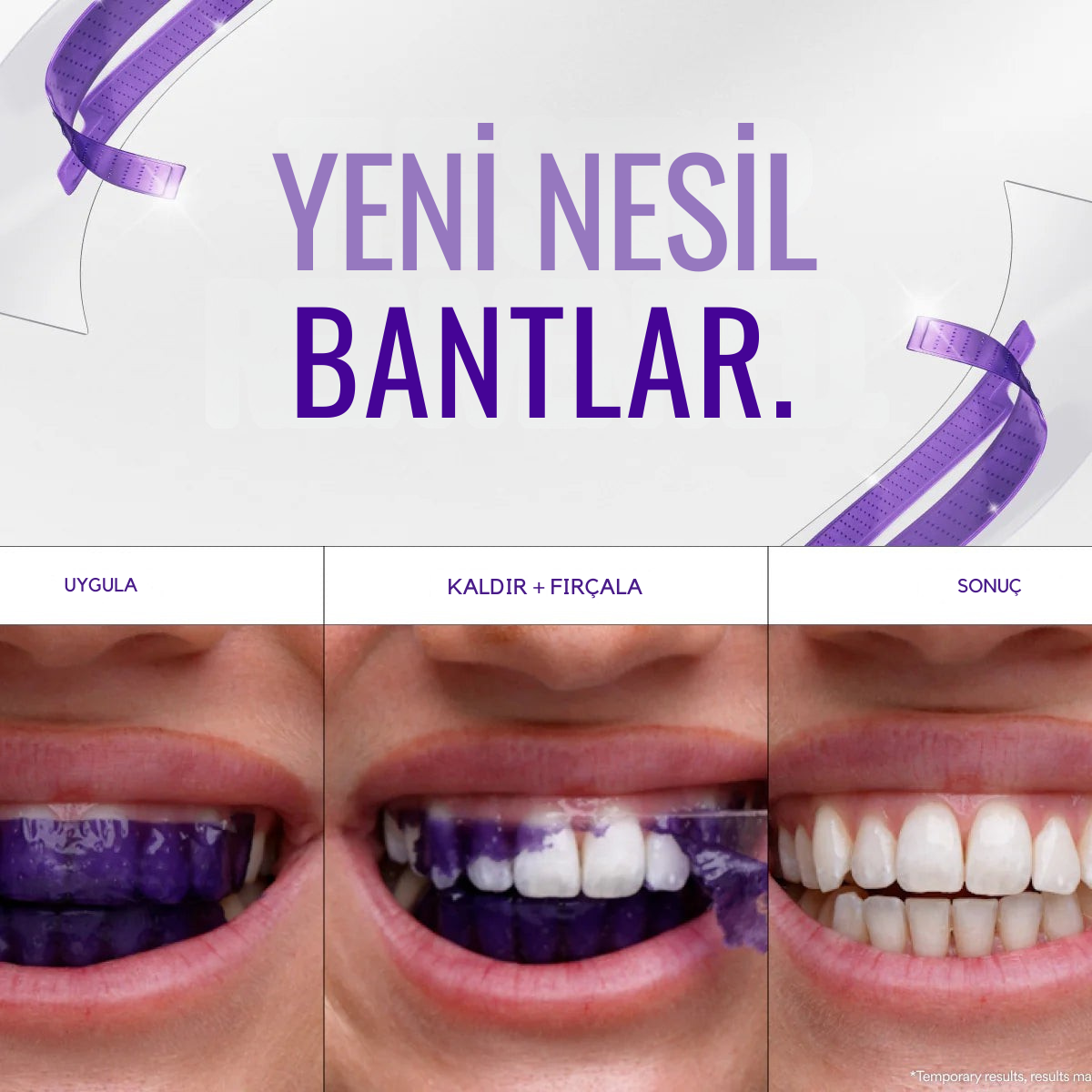 Duyora - Çift Etkili Diş Beyazlatma Bantları